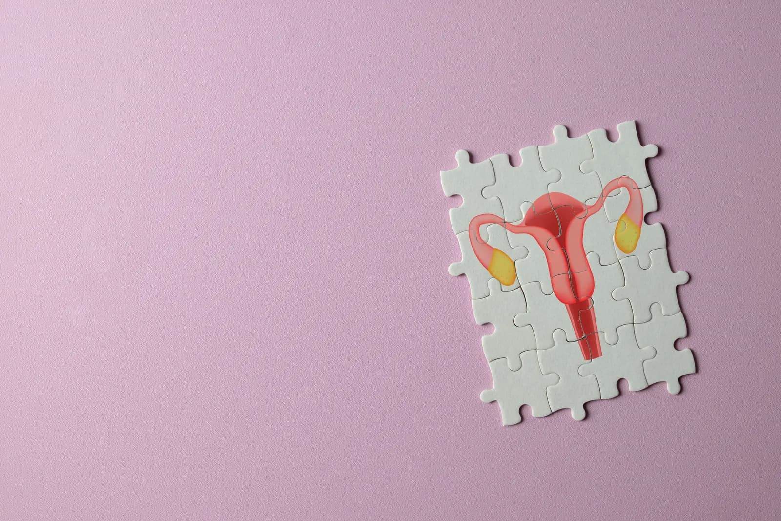 GLP-1 and PCOS/ PMOS: A Promising Match?