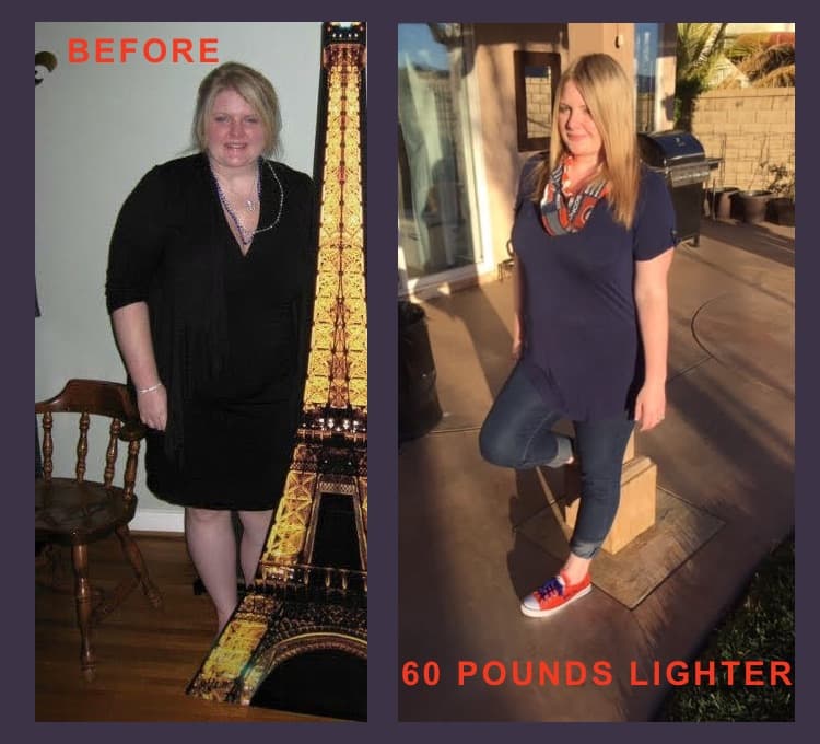 Alexandra Before / After bariatric surgery
