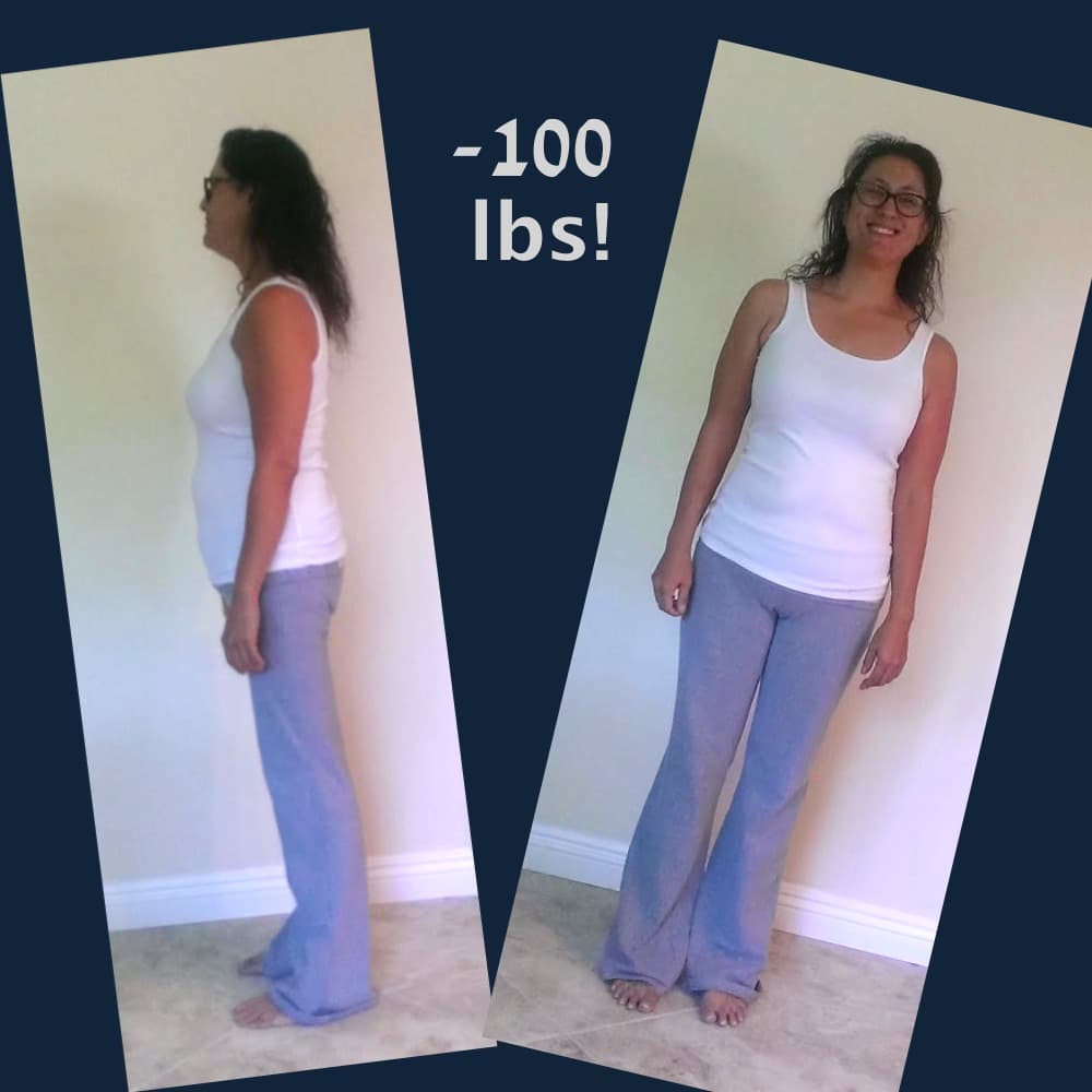 Kellie After bariatric surgery
