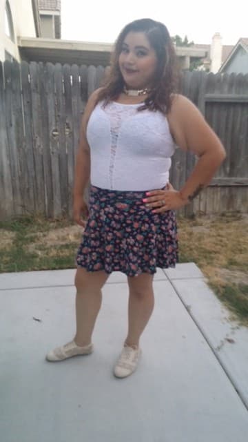 IJ after bariatric surgery