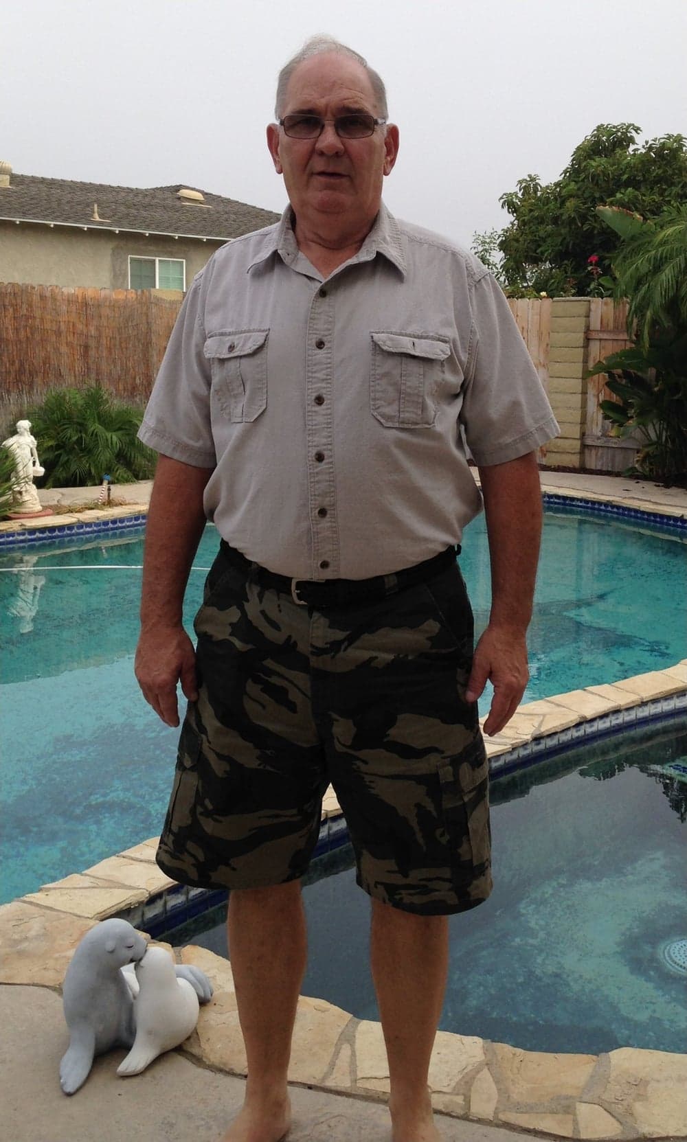 James after bariatric surgery