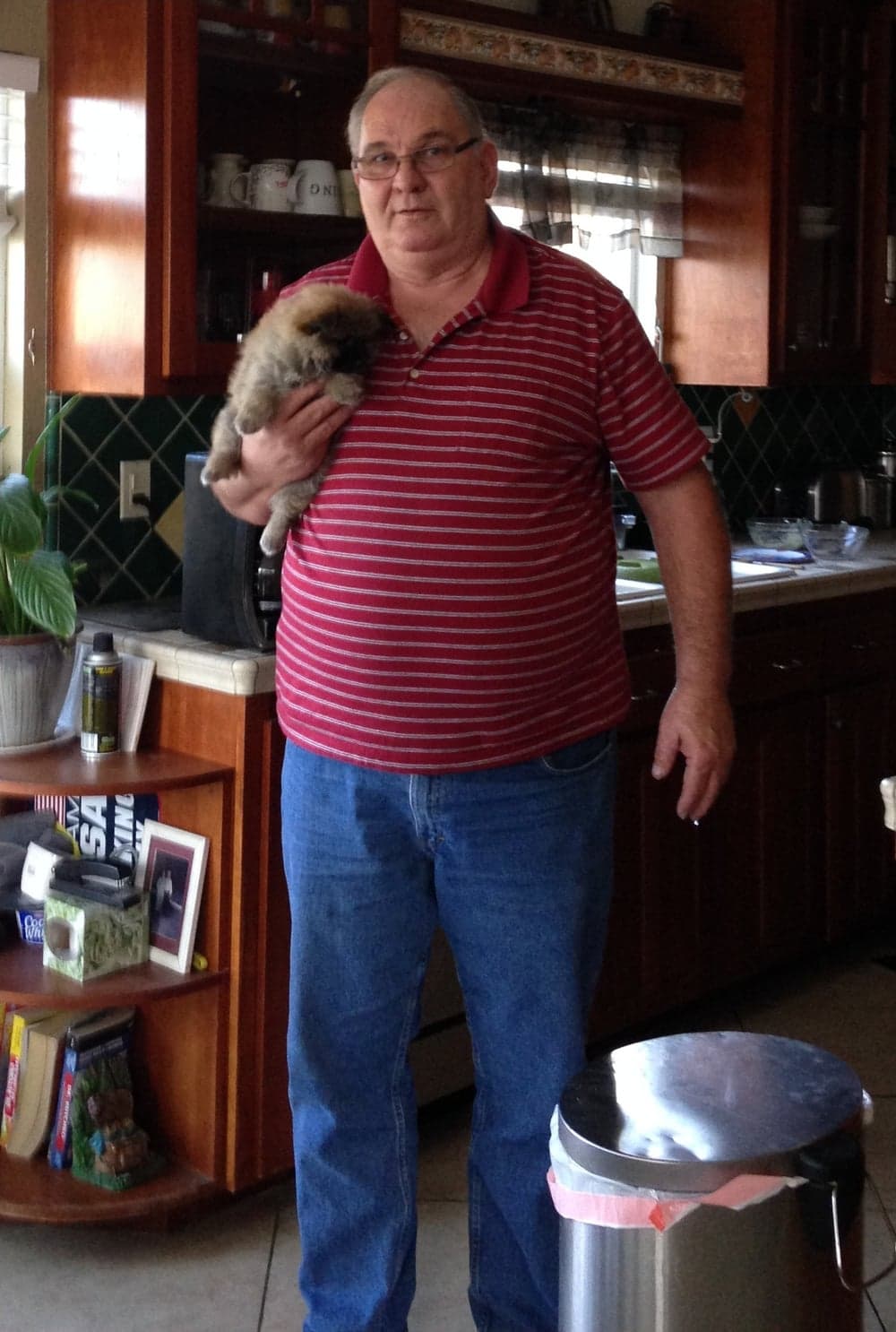 James before bariatric surgery