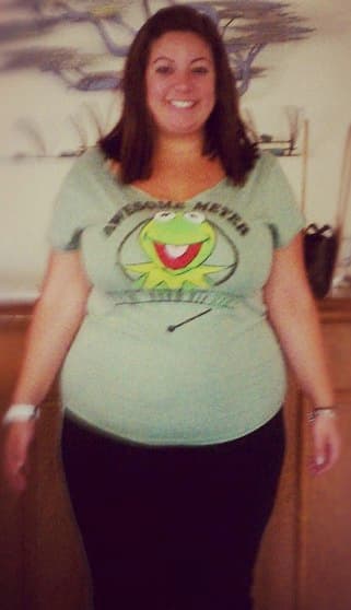 Sant before bariatric surgery