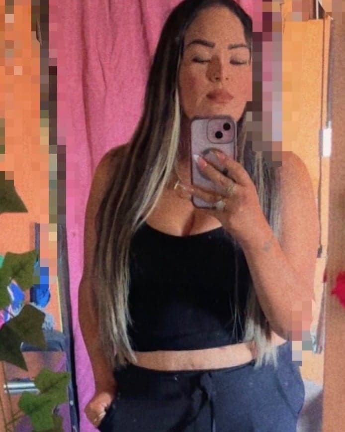 Yazmin after bariatric surgery