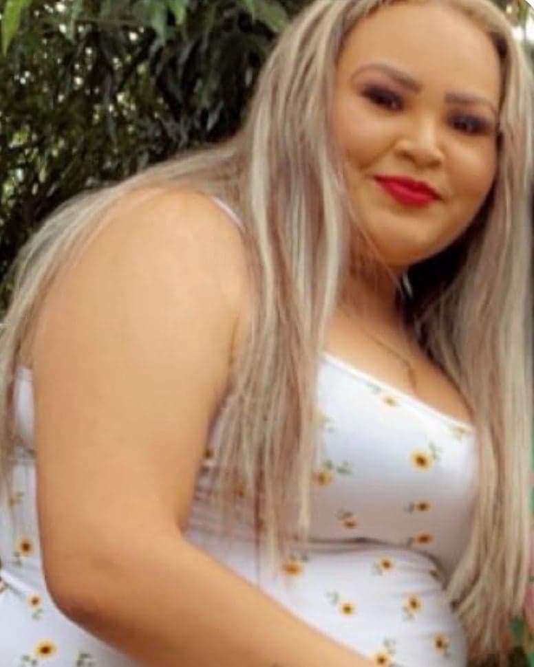 Yazmin before bariatric surgery
